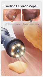 Upgraded Smart Visual Ear Wax Cleaner With Camera 800W HD Endoscope Multi-Functional Visual Ear Cleaning Tool Includes Storage