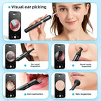 Wireless Ear Wax Removal With Camera Rechargeable Ear Cleaner HD Check Camera with Ear Spoon Set Canal Clean