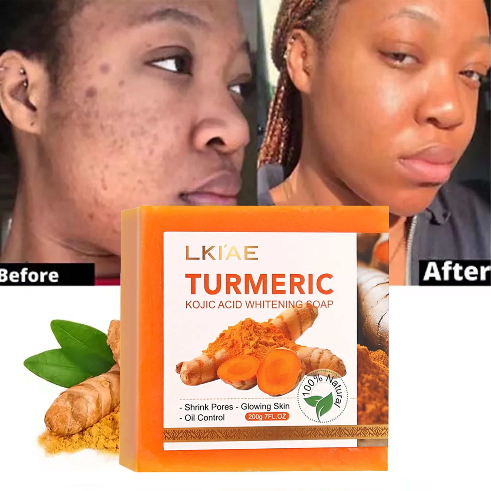 LKIAE Organic Turmeric Soap Bar, Natural Herbal Hand Made Whitening Soap, Remove Melanin, Acne, Spots, For Face And Body,200g Main image