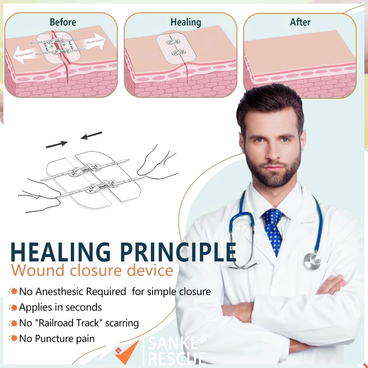 2-4PCS Zipper Painless Wound Closure Device Suture-free Wound Dressing Closure Strips Kit Emergency Laceration Closures for Ifak Secondary image